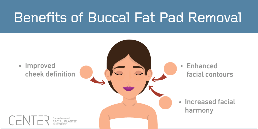 The Difference Between Buccal Fat Pad Removal and Cheek Liposuction: Which  One Is Right For Me? - CENTER for Advanced Facial Plastic Surgery