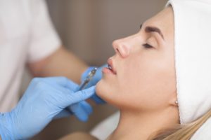 Juvederm Fillers