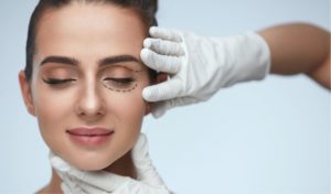 Laser Blepharoplasty consultation