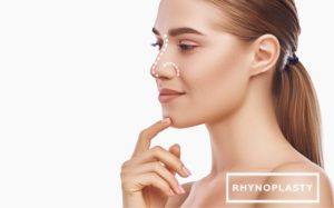 rhinoplasty