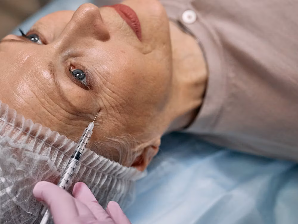 Close-up of collagen-stimulating injectable being administered to a patient's face