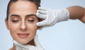 Woman preparing for eyelid surgery