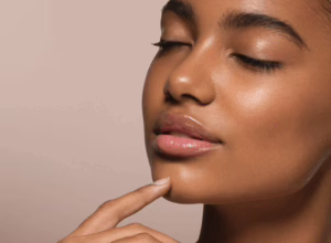 woman with deep-plane facelift