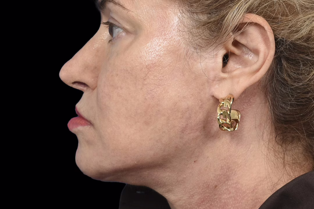 womans side profile