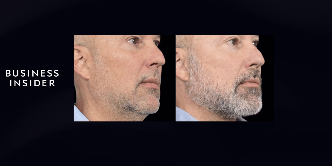 Dr. Azzizzadeh featured in business insider