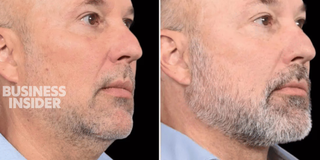 Dr. Azzizzadeh featured in business insider