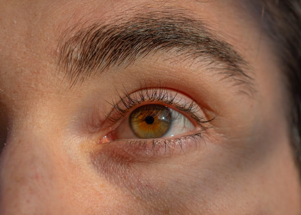  Close-up of rejuvenated eye area