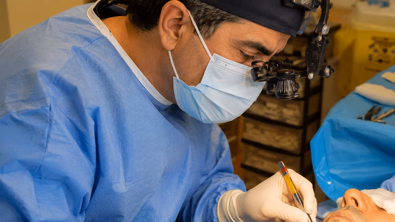 : Illustration of facial nerve anatomy during deep plane facelift dissection layers